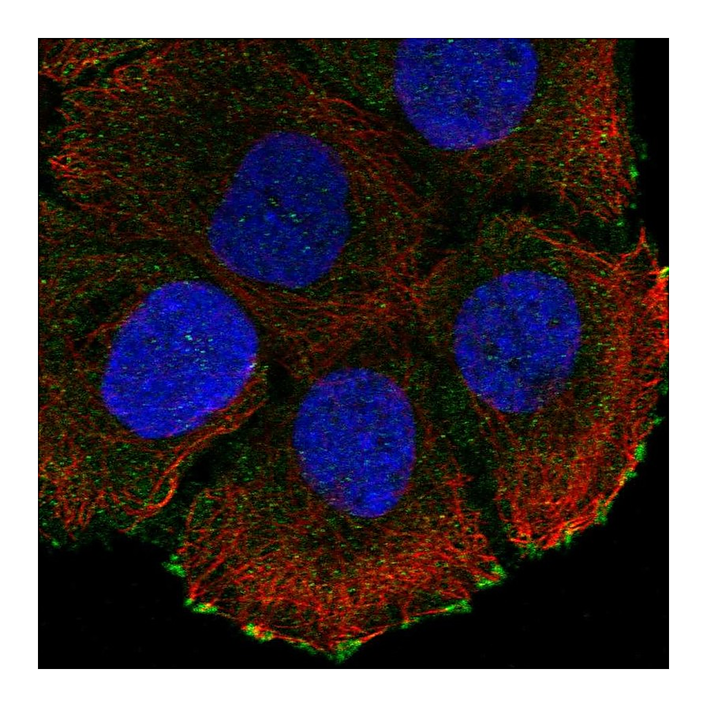 Atlas Antibodies Anti-ATP2C2 Antibody