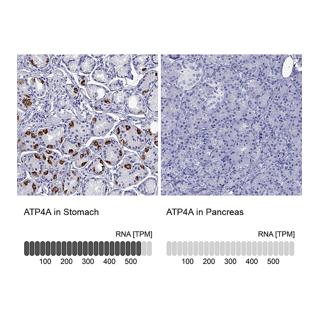 Atlas Antibodies Anti-ATP4A Antibody