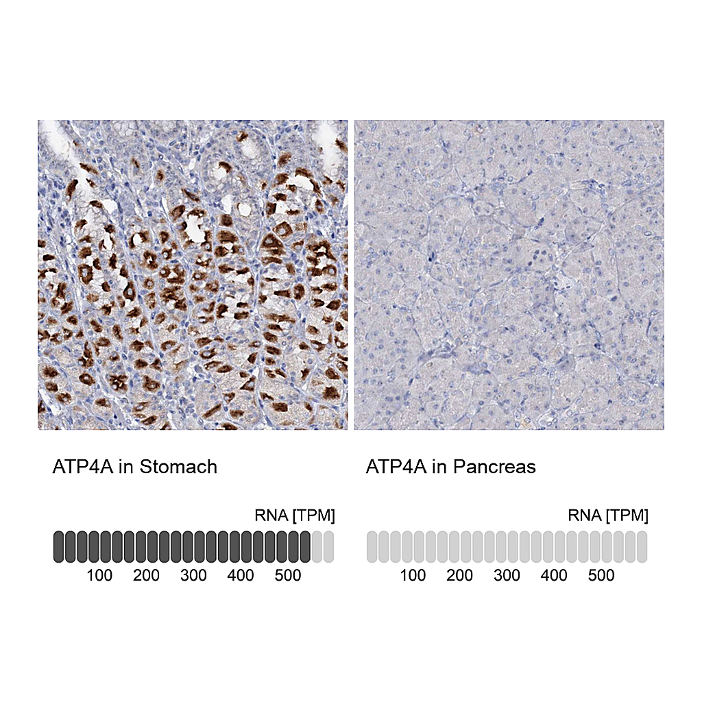 Atlas Antibodies Anti-ATP4A Antibody