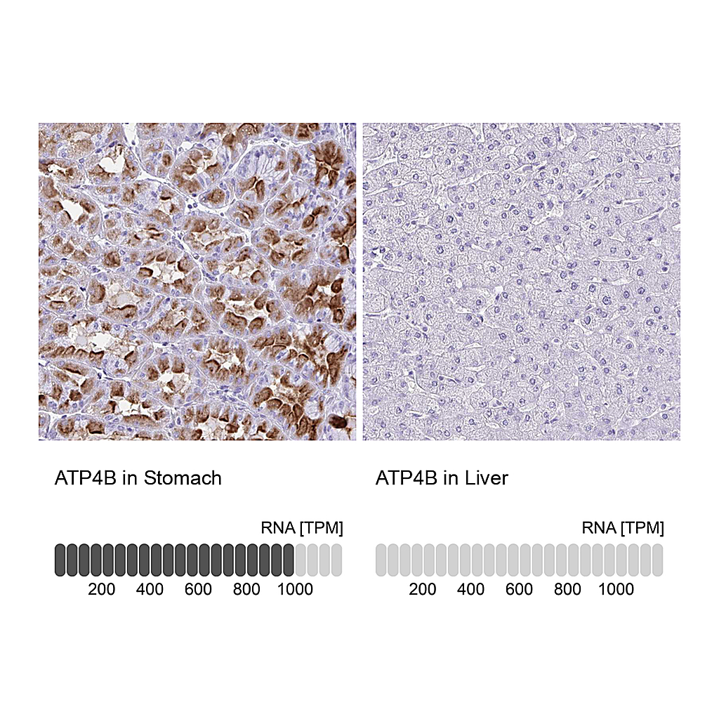 Atlas Antibodies Anti-ATP4B Antibody