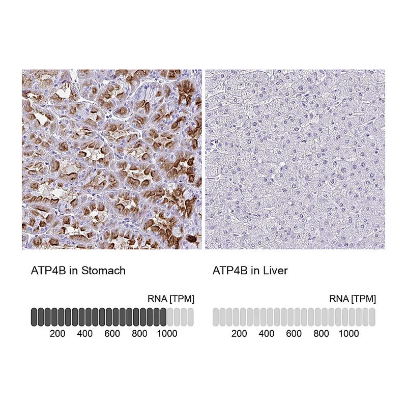 Atlas Antibodies Anti-ATP4B Antibody