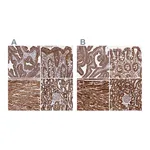 Atlas Antibodies Anti-ATP5A1 Antibody