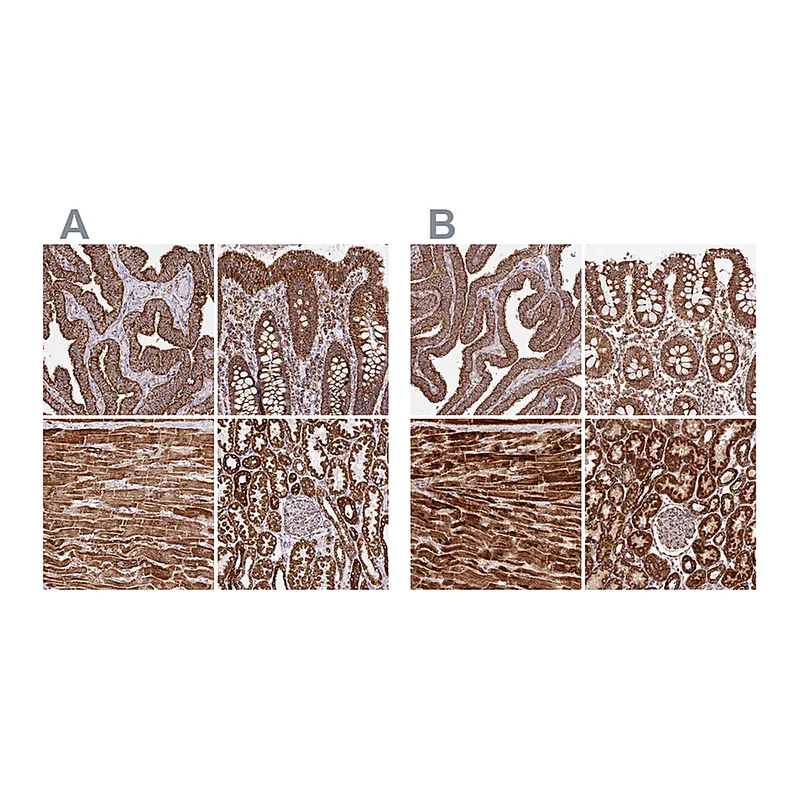 Atlas Antibodies Anti-ATP5A1 Antibody