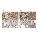 Atlas Antibodies Anti-ATP5B Antibody