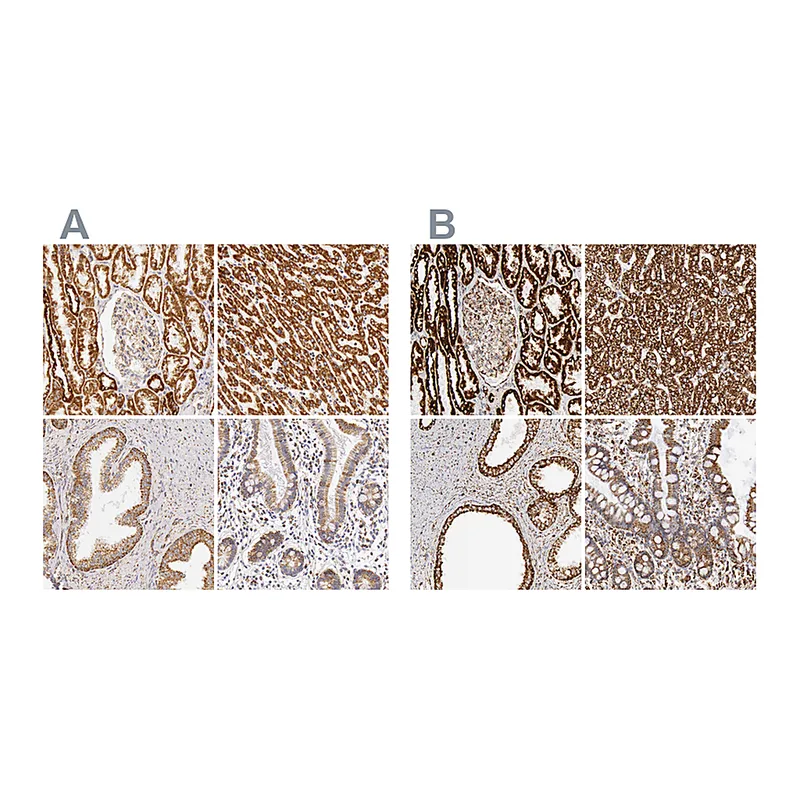 Atlas Antibodies Anti-ATP5B Antibody