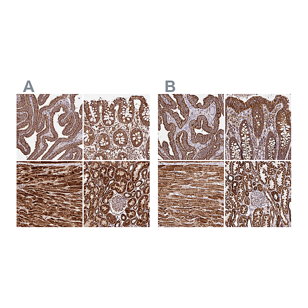 Atlas Antibodies Anti-ATP5A1 Antibody