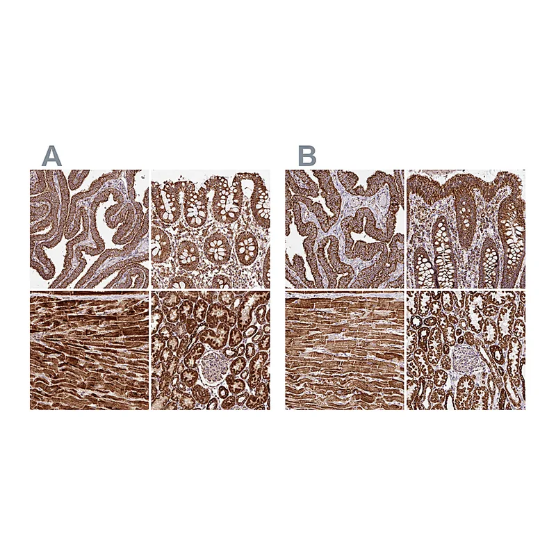 Atlas Antibodies Anti-ATP5A1 Antibody