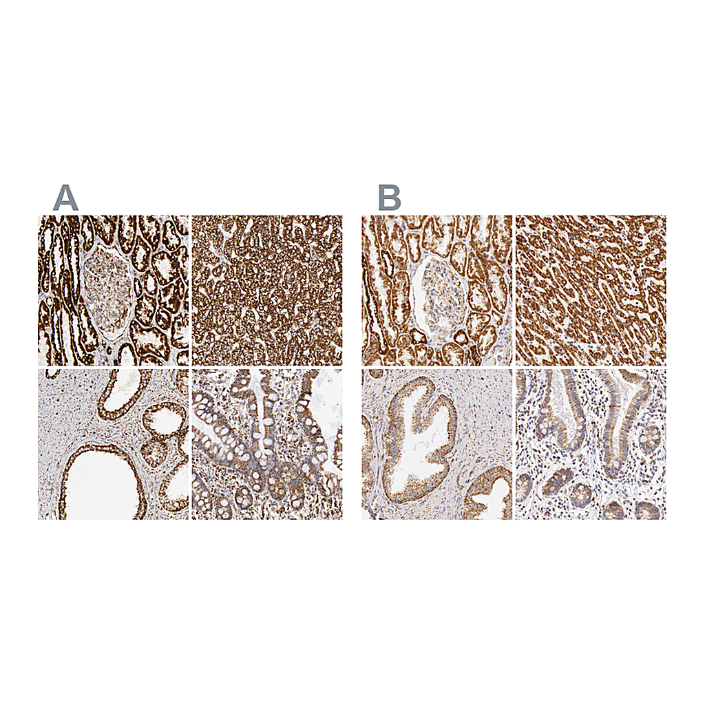 Atlas Antibodies Anti-ATP5B Antibody