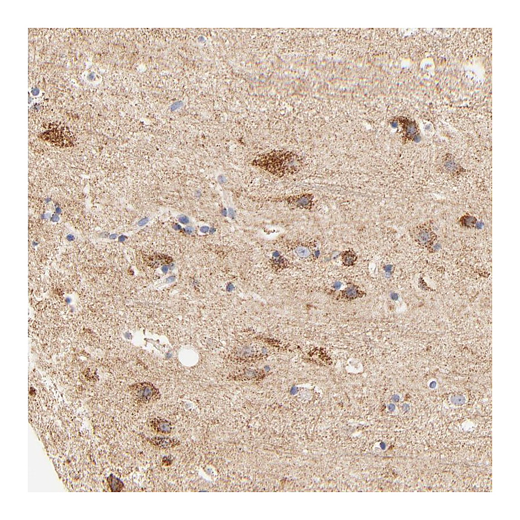 Atlas Antibodies Anti-ATP5D Antibody