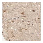 Atlas Antibodies Anti-ATP5D Antibody