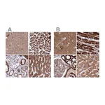Atlas Antibodies Anti-ATP5H Antibody