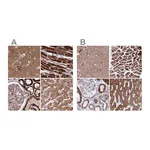 Atlas Antibodies Anti-ATP5H Antibody