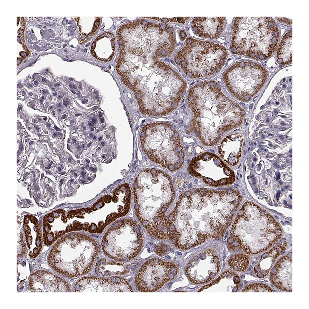 Atlas Antibodies Anti-ATP5J2 Antibody