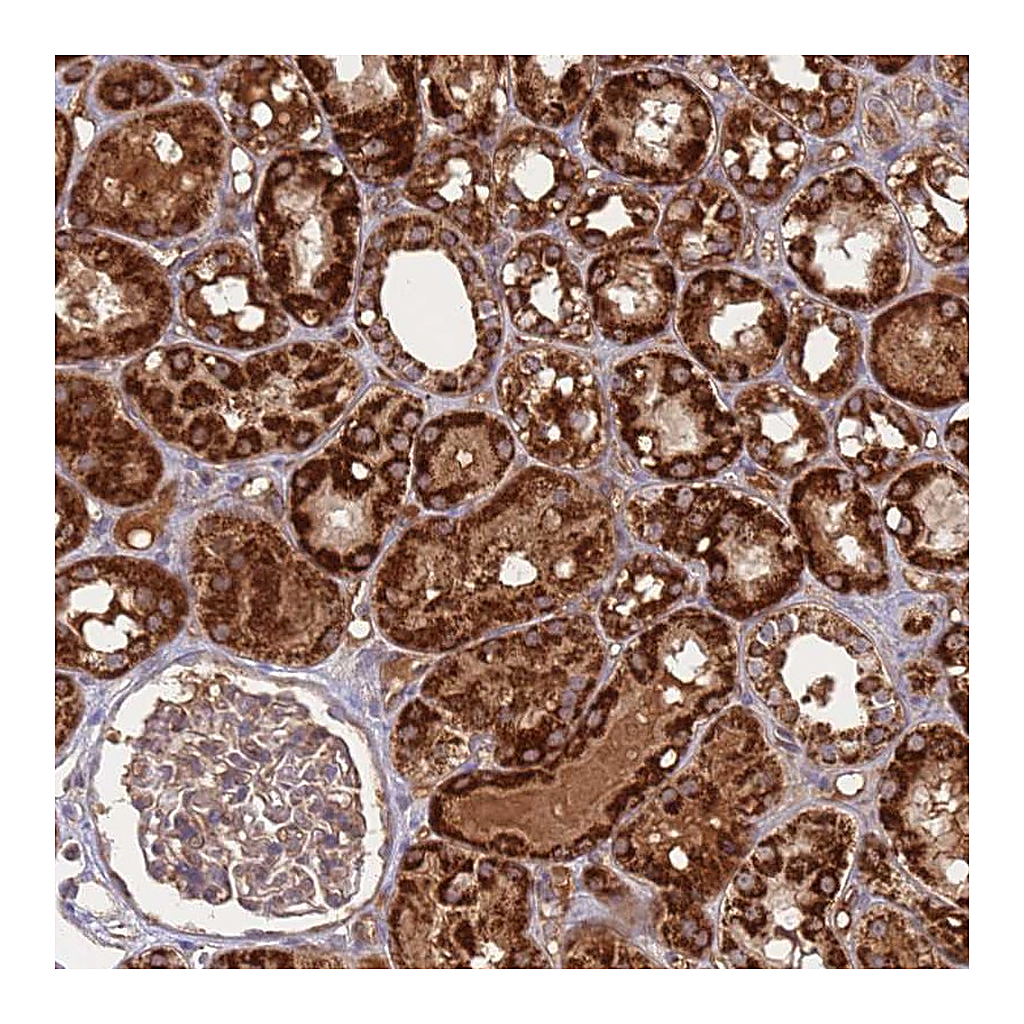 Atlas Antibodies Anti-ATP5S Antibody