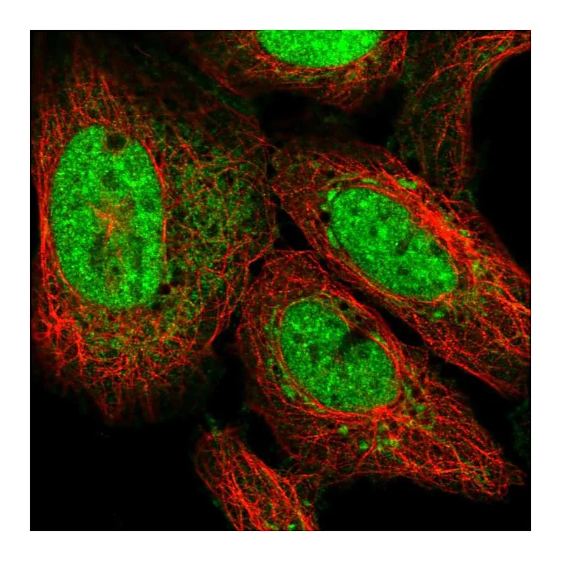 Atlas Antibodies Anti-ATP5S Antibody