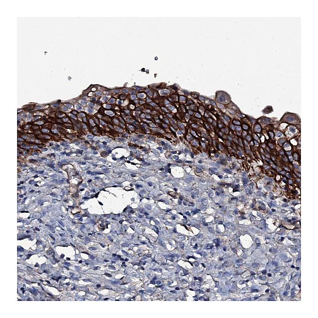 Atlas Antibodies Anti-ATP5SL Antibody