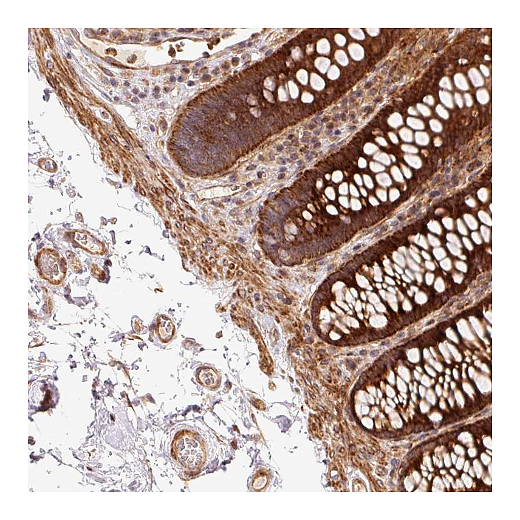 Atlas Antibodies Anti-ATP6AP1L Antibody