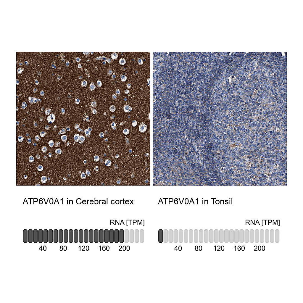 Atlas Antibodies Anti-ATP6V0A1 Antibody