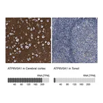 Atlas Antibodies Anti-ATP6V0A1 Antibody