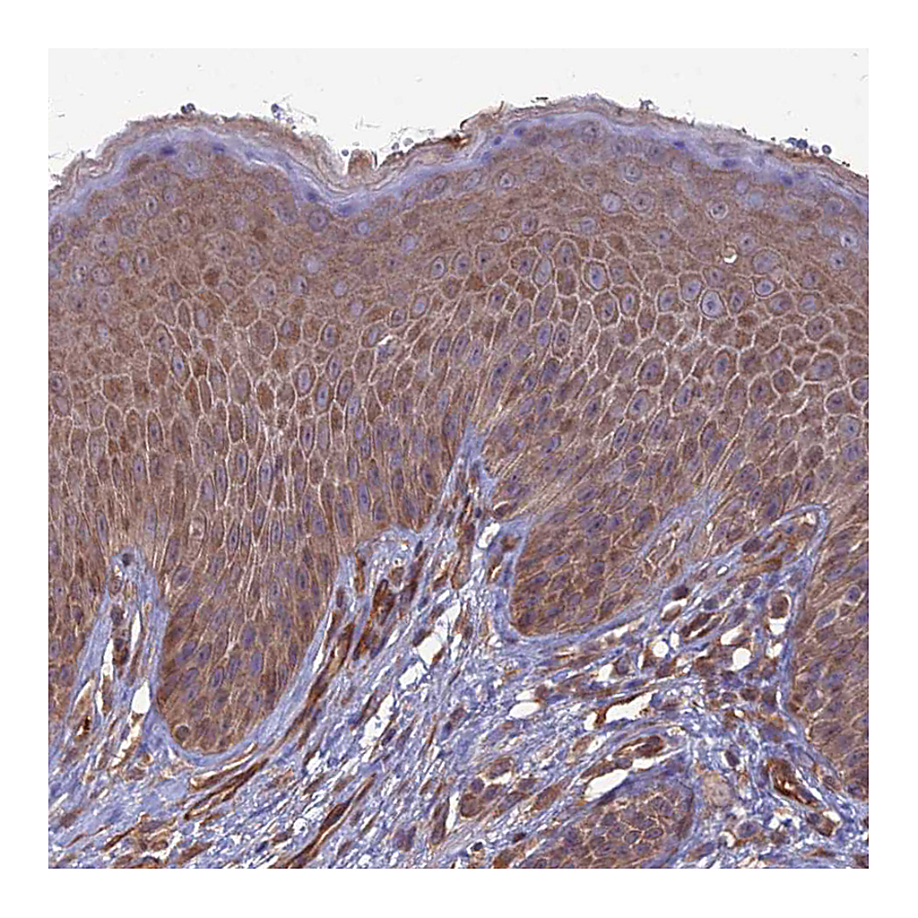 Atlas Antibodies Anti-ATP6V0A2 Antibody