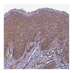 Atlas Antibodies Anti-ATP6V0A2 Antibody
