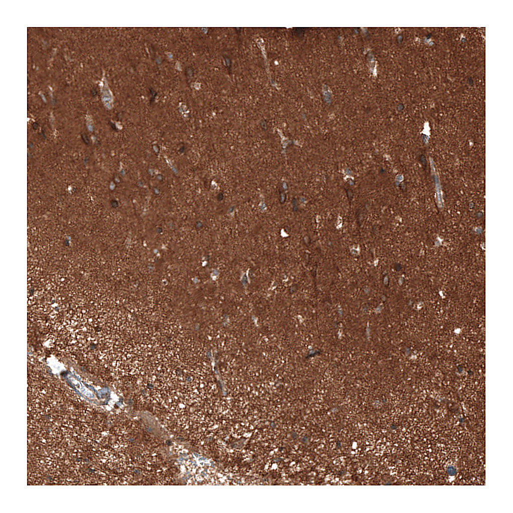 Atlas Antibodies Anti-ATP6AP2 Antibody