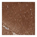 Atlas Antibodies Anti-ATP6AP2 Antibody