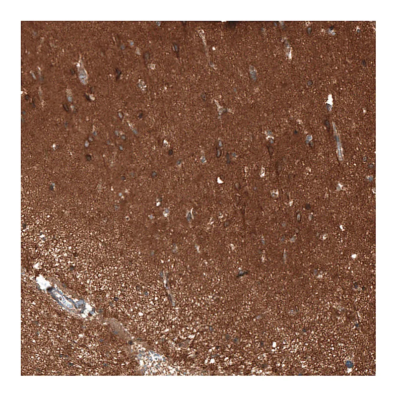 Atlas Antibodies Anti-ATP6AP2 Antibody