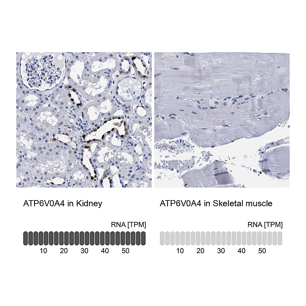 Atlas Antibodies Anti-ATP6V0A4 Antibody