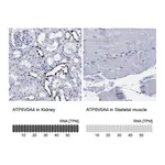 Atlas Antibodies Anti-ATP6V0A4 Antibody