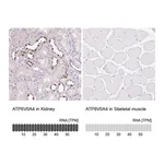 Atlas Antibodies Anti-ATP6V0A4 Antibody