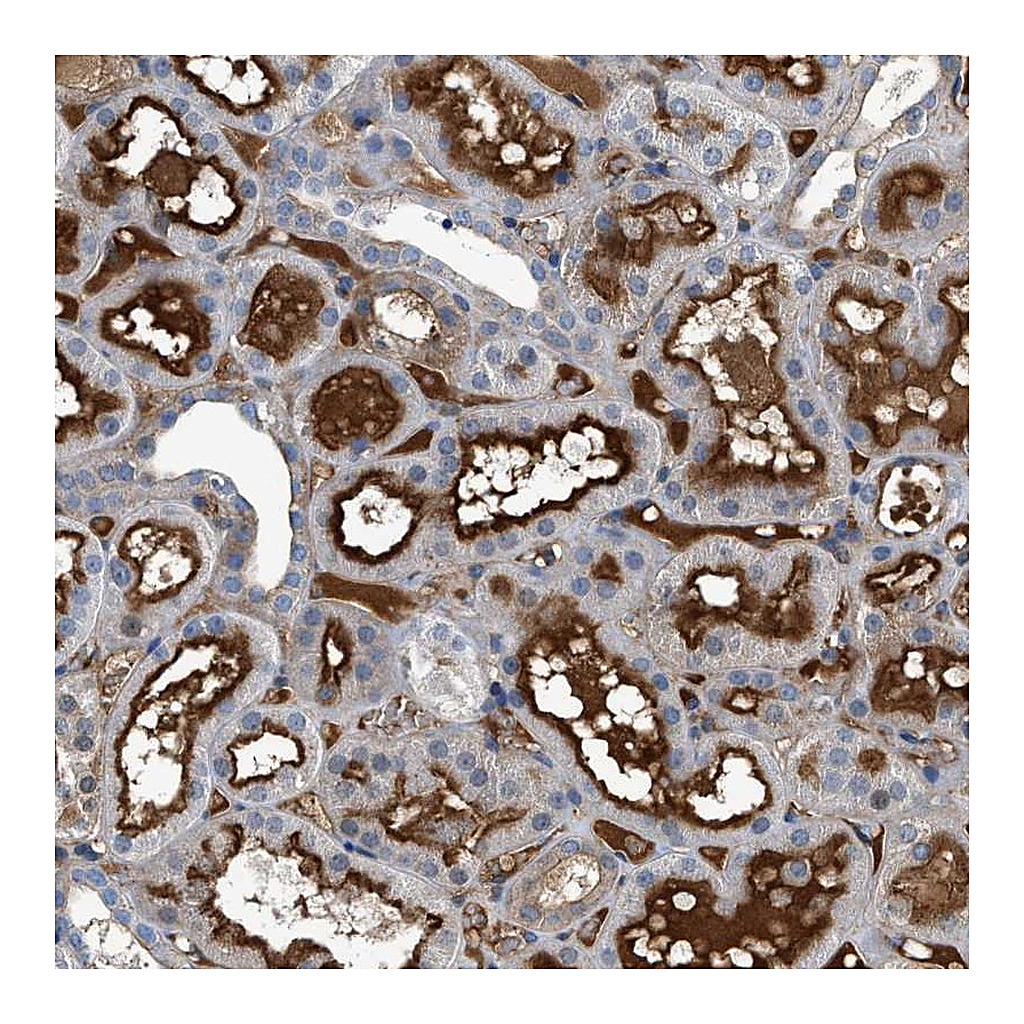 Atlas Antibodies Anti-ATP6V0D1 Antibody