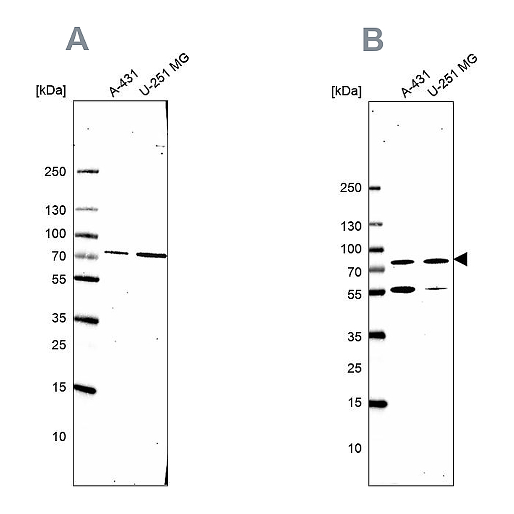Atlas Antibodies Anti-ATP6V1A Antibody