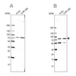 Atlas Antibodies Anti-ATP6V1A Antibody