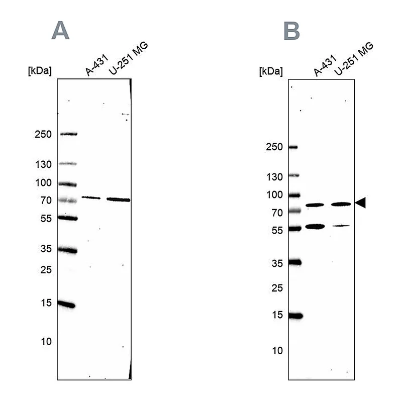 Atlas Antibodies Anti-ATP6V1A Antibody