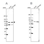 Atlas Antibodies Anti-ATP6V1A Antibody