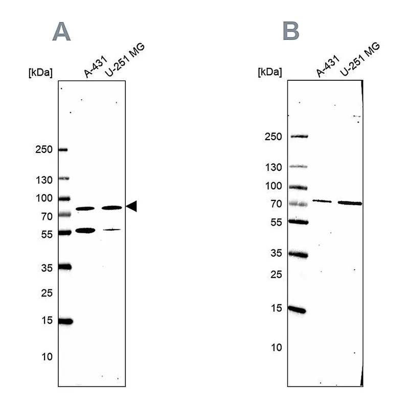Atlas Antibodies Anti-ATP6V1A Antibody
