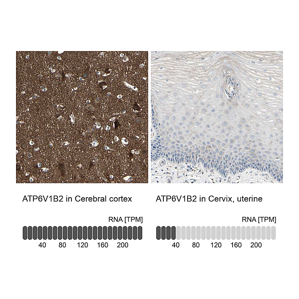Atlas Antibodies Anti-ATP6V1B2 Antibody