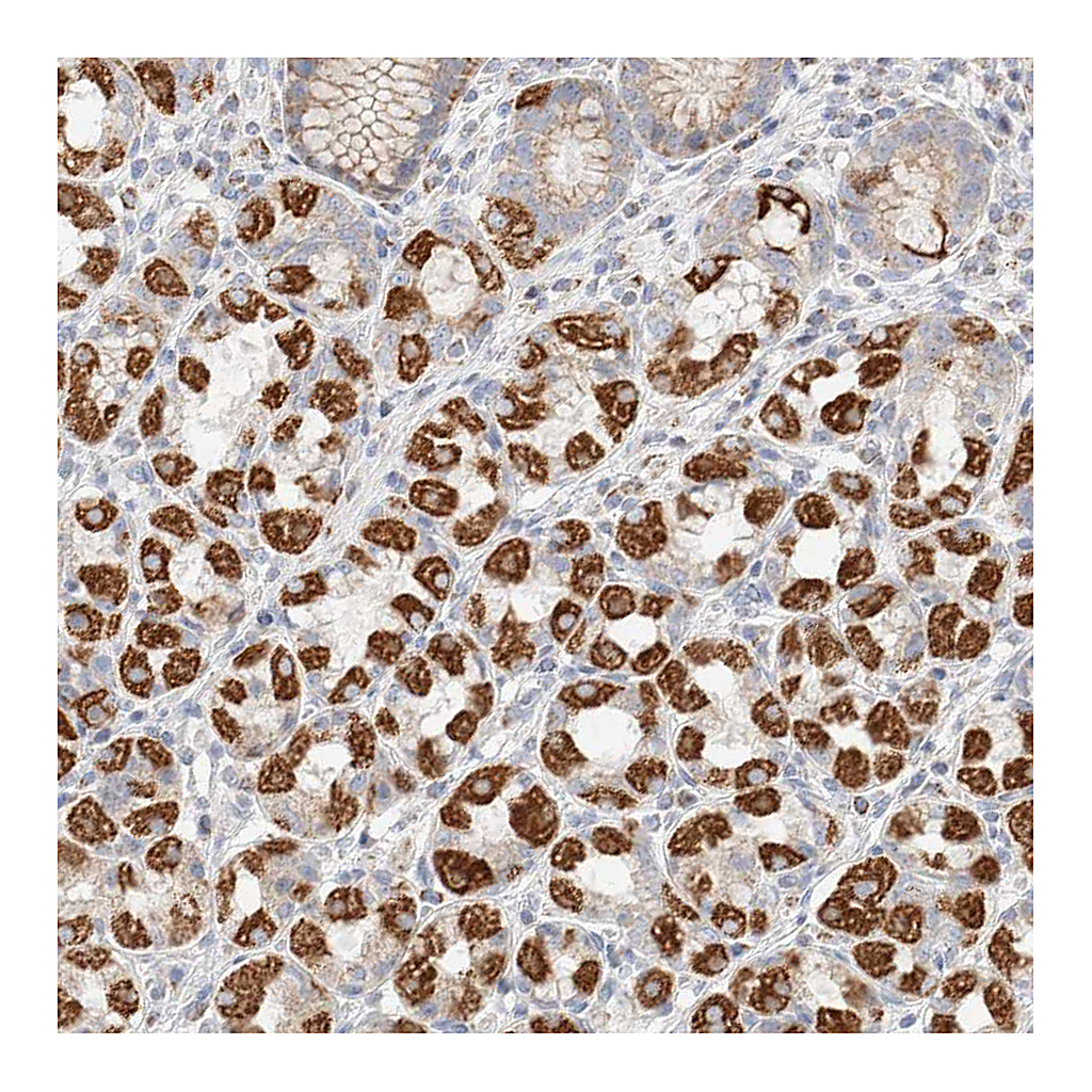 Atlas Antibodies Anti-ATP6V1C1 Antibody