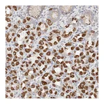 Atlas Antibodies Anti-ATP6V1C1 Antibody