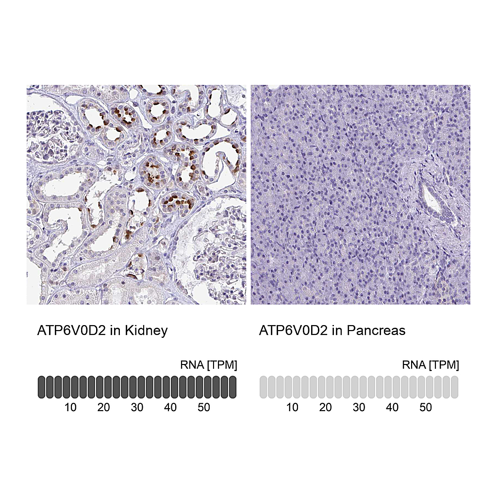 Atlas Antibodies Anti-ATP6V0D2 Antibody