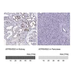Atlas Antibodies Anti-ATP6V0D2 Antibody