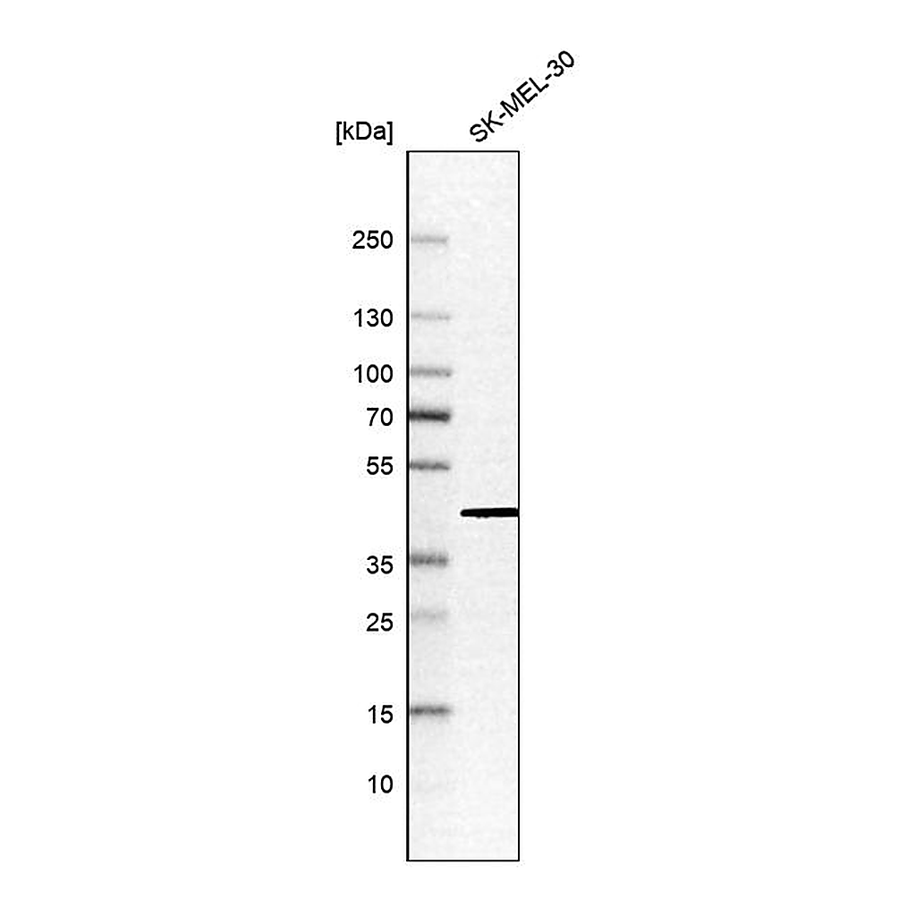 Atlas Antibodies Anti-ATP6V1C1 Antibody