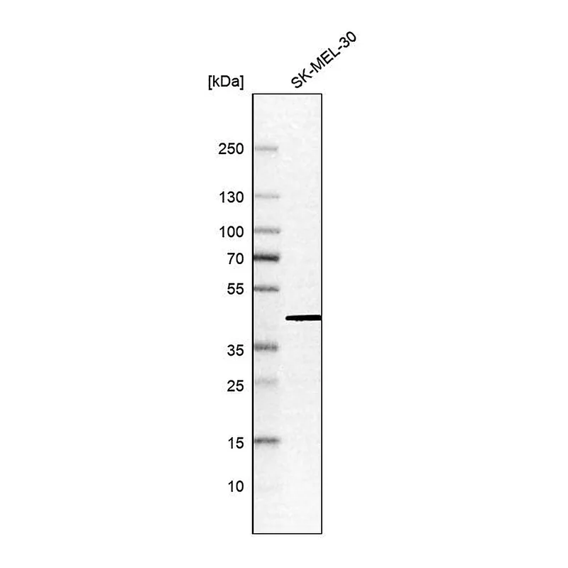 Atlas Antibodies Anti-ATP6V1C1 Antibody