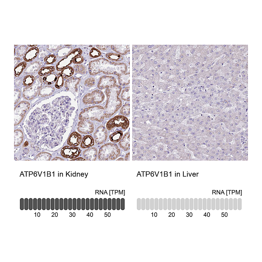 Atlas Antibodies Anti-ATP6V1B1 Antibody