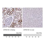 Atlas Antibodies Anti-ATP6V1B1 Antibody