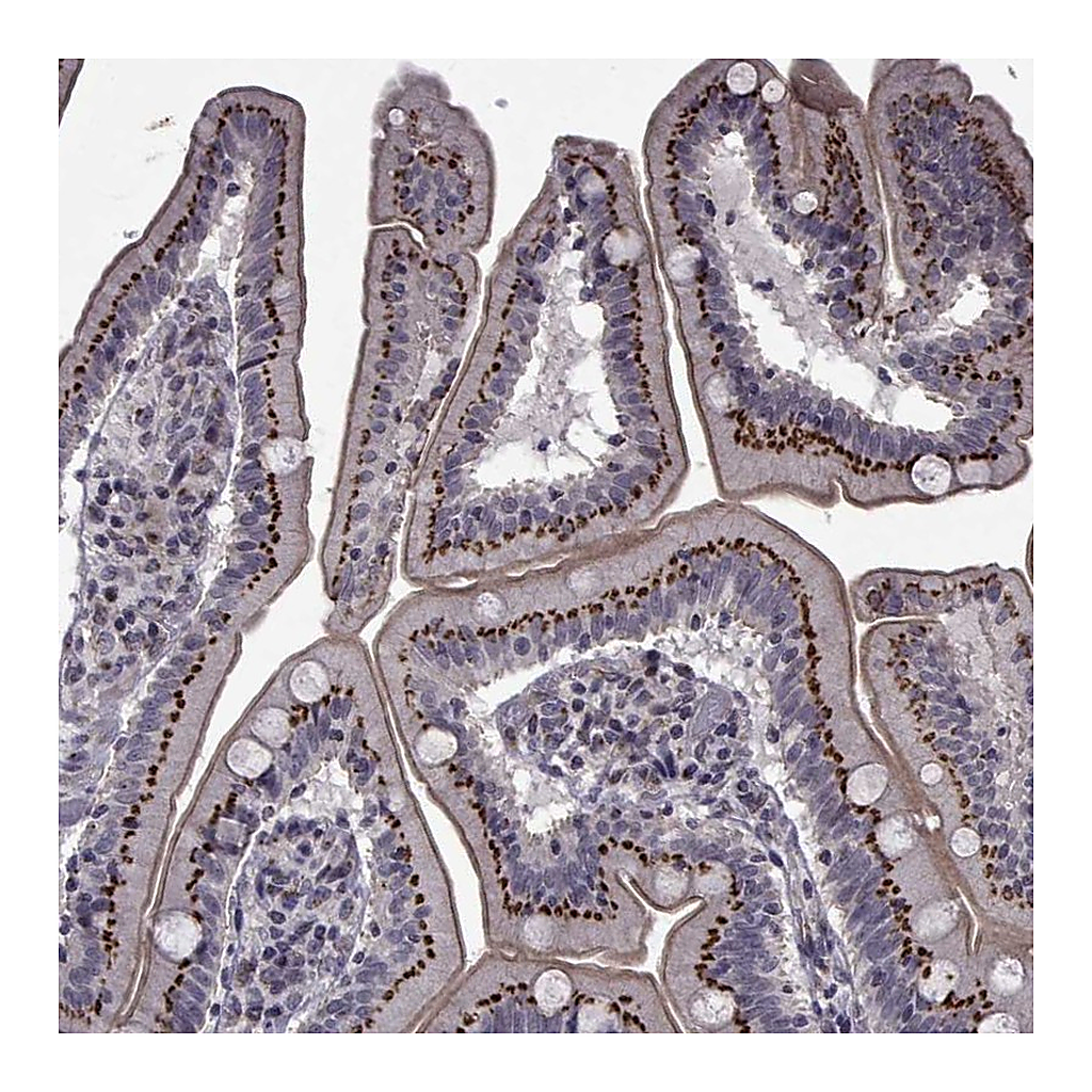 Atlas Antibodies Anti-ATP6V1C2 Antibody