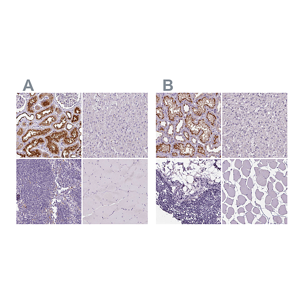 Atlas Antibodies Anti-ATP6V1D Antibody