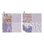 Atlas Antibodies Anti-ATP6V1D Antibody