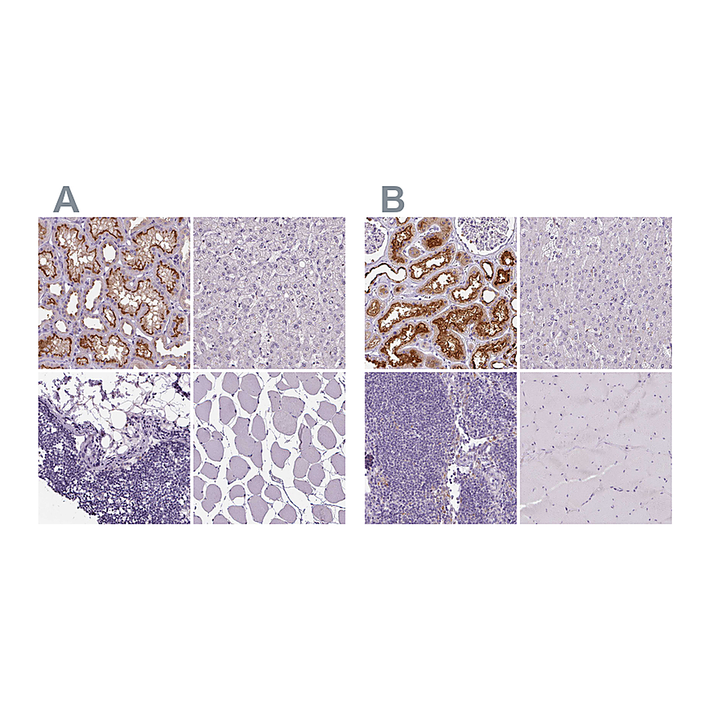 Atlas Antibodies Anti-ATP6V1D Antibody